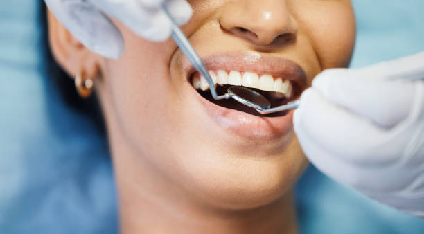 Best Emergency Wisdom Teeth Removal in New Hyde Park, NY